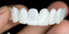 100% Adjustable Invisible Whitening Braces - No Holes