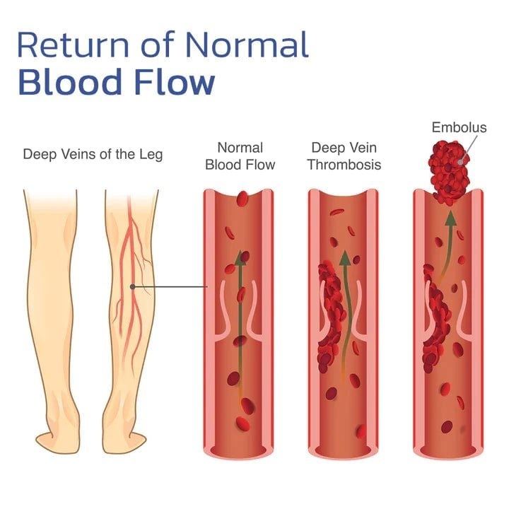 KneeRelief™ | Fast Relief Your Knees Deserve!
