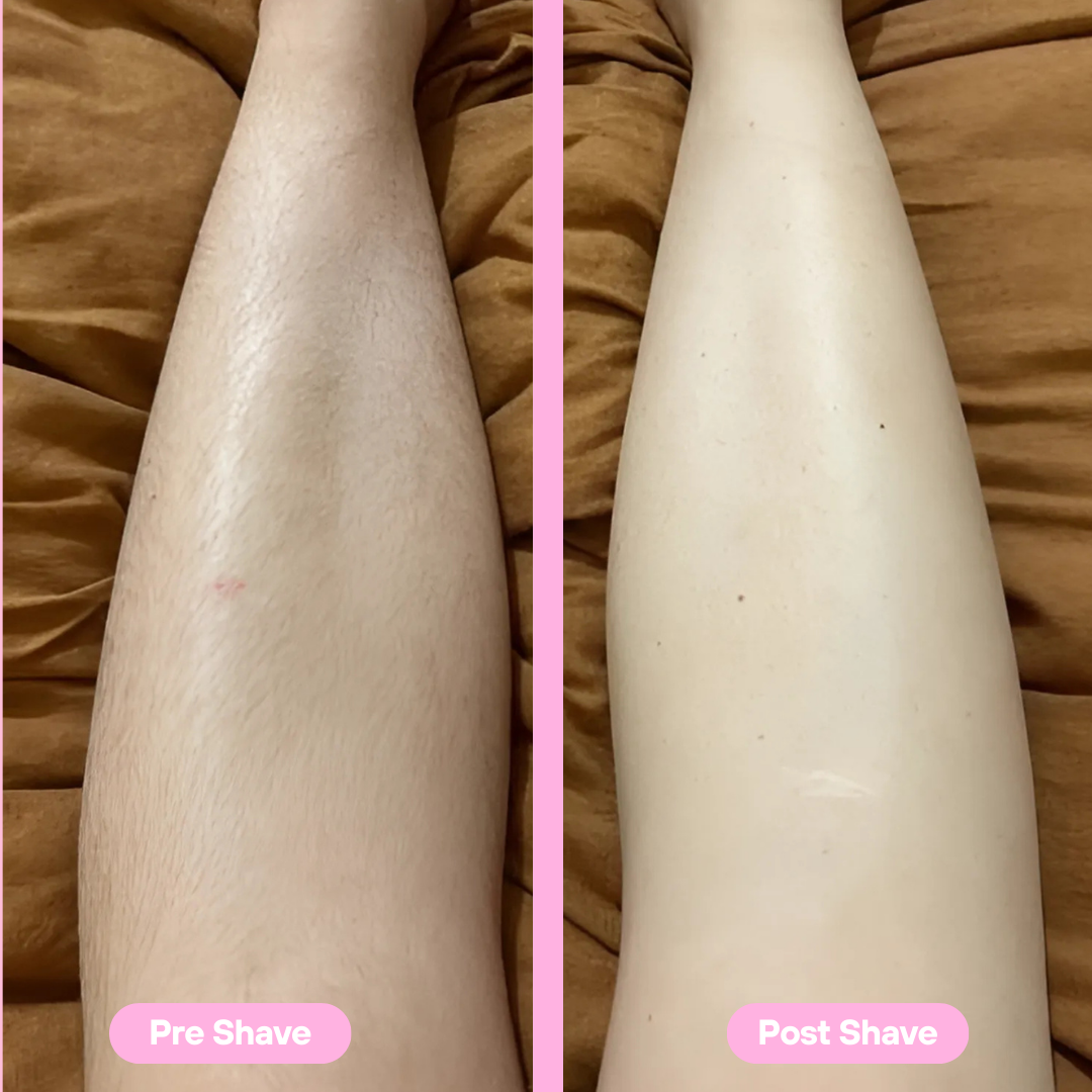 PureSmooth™ | Experience Pain-Free, Bump-Free Hair Removal