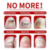 FungaRelief™ | Natural Fungus Removal in 7 Days!