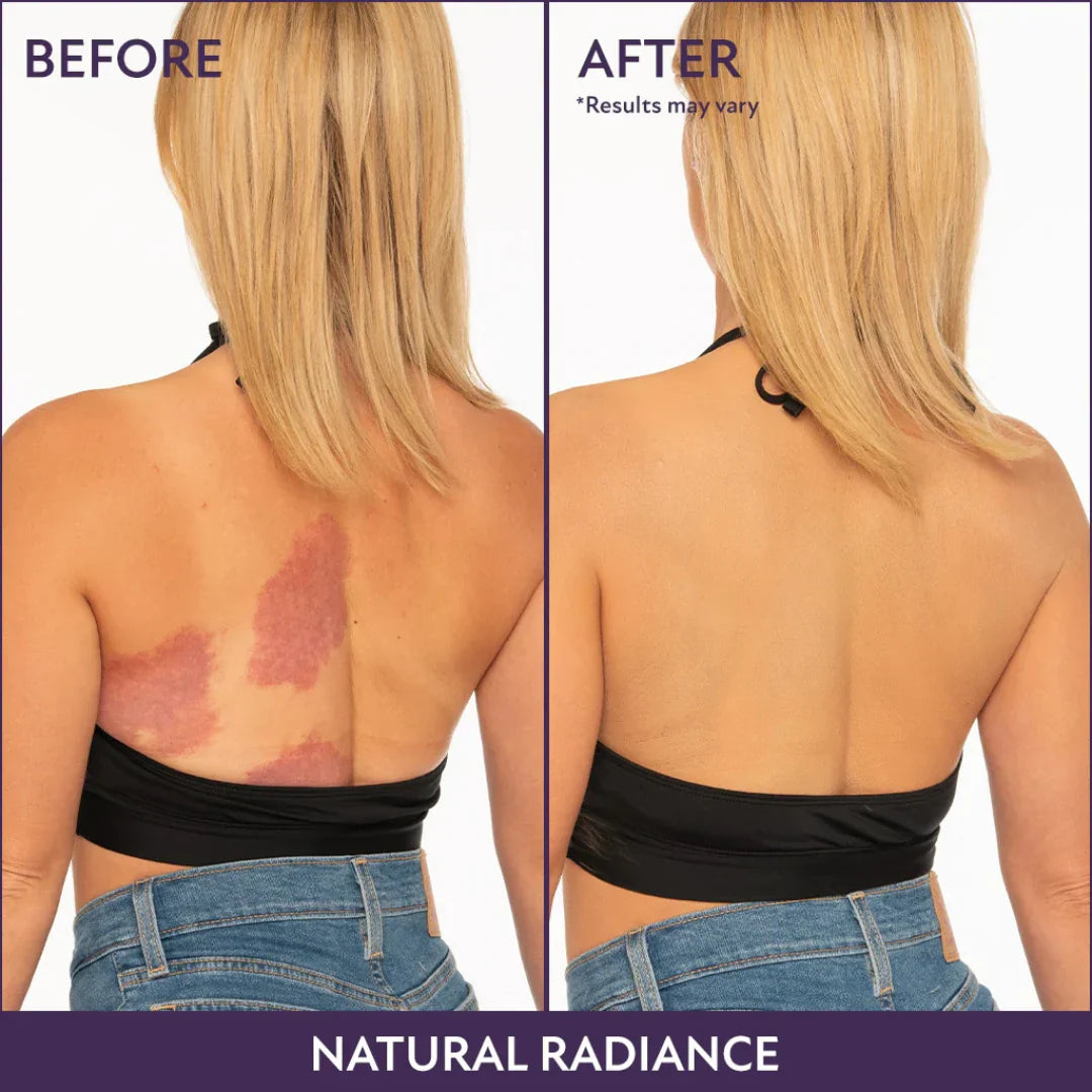 BodyBlur™ | Seamless Body Coverage That Won’t Budge