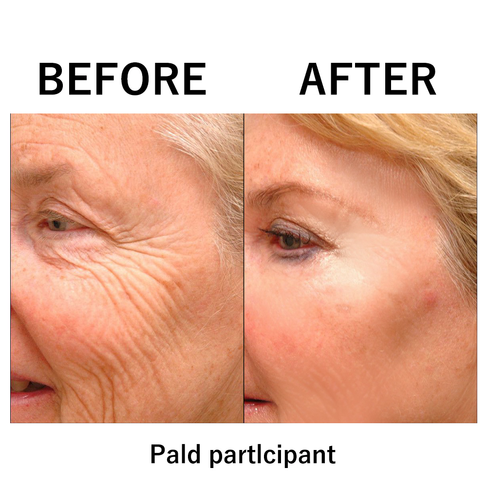 LiftGlow™ | Instantly Lift & Firm Your Skin for a Radiant, Youthful Look