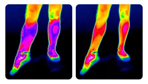KneeRelief™ | Fast Relief Your Knees Deserve!