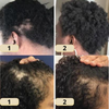 GrowEssence™ | The Most Effective Remedy For Fast Hair Growth