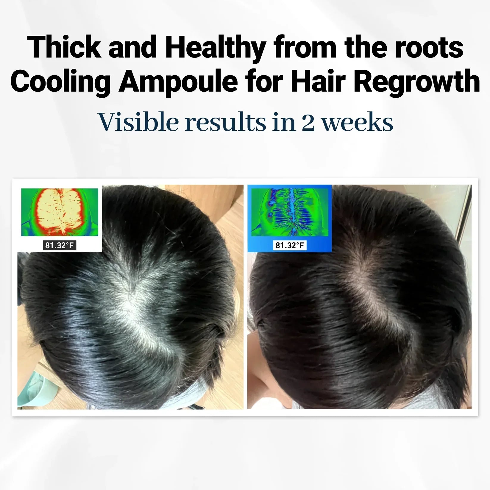 Hairvera™ | Where Thin Hair Becomes Thick Again!