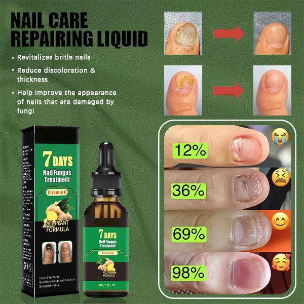 FungaRelief™ | Natural Fungus Removal in 7 Days!