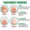 FungaRelief™ | Natural Fungus Removal in 7 Days!