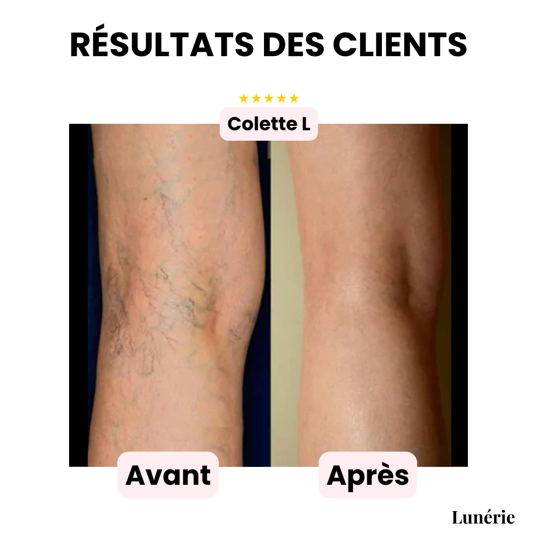 InvisiCover™ | Hide Imperfections, Shine Naturally!