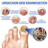 NailEssence™ | Fungus Laser Therapy Device