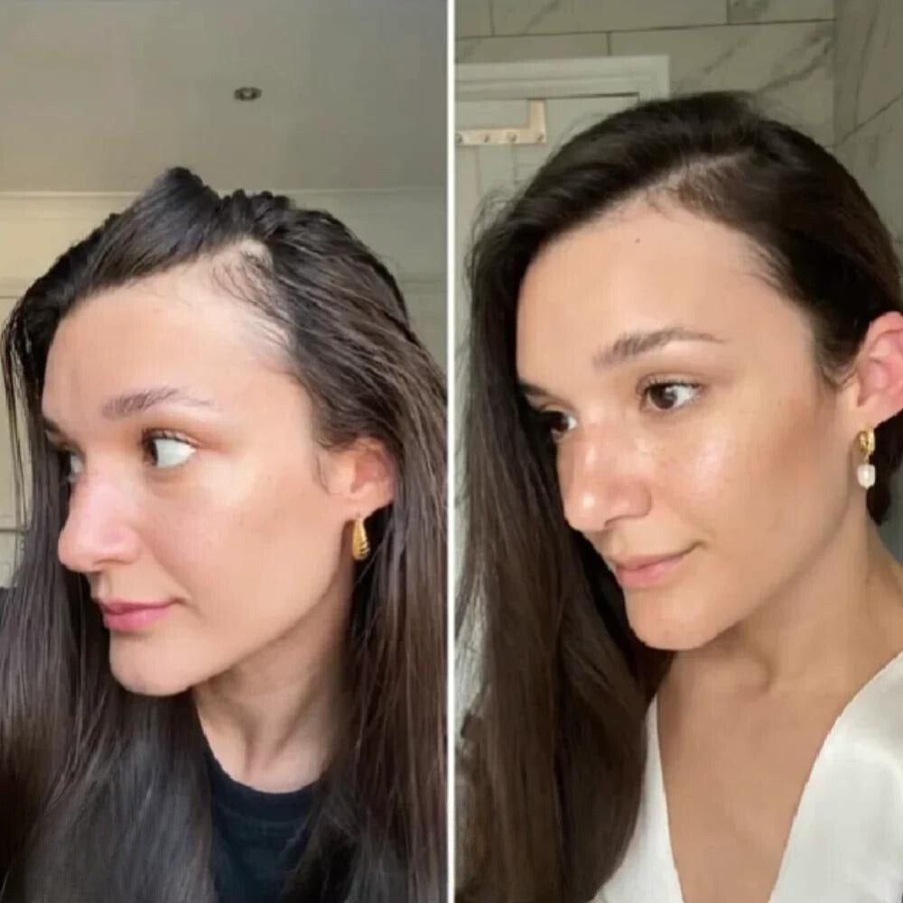 GrowEssence™ | The Most Effective Remedy For Fast Hair Growth