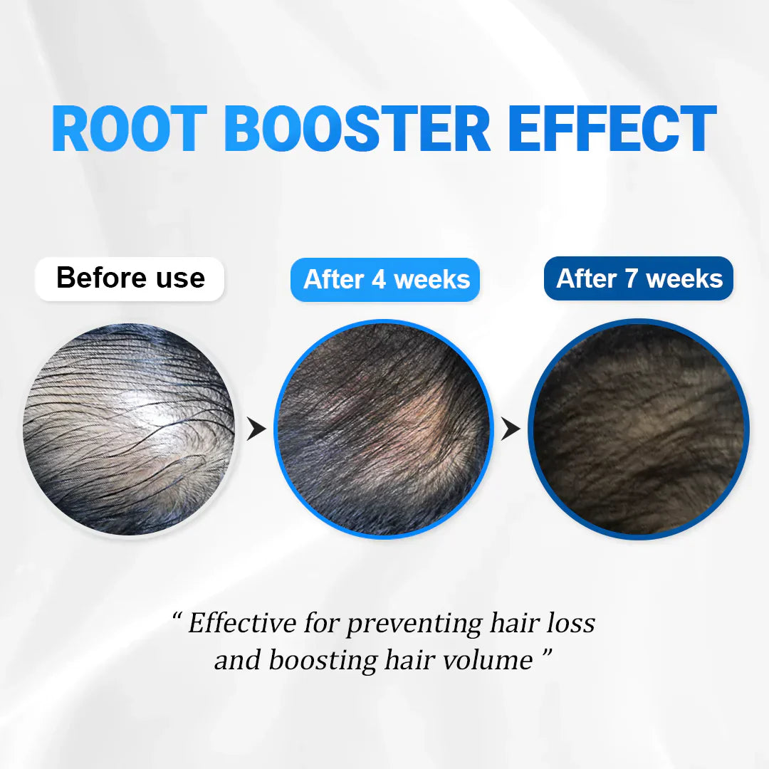 Hairvera™ | Where Thin Hair Becomes Thick Again!