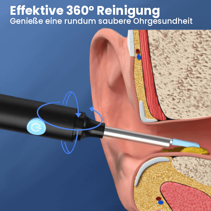 EarVision™ | See, Clean, and Care for Your Ears Safely!