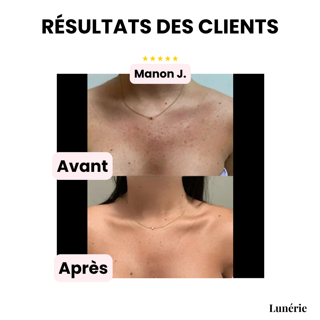 InvisiCover™ | Hide Imperfections, Shine Naturally!