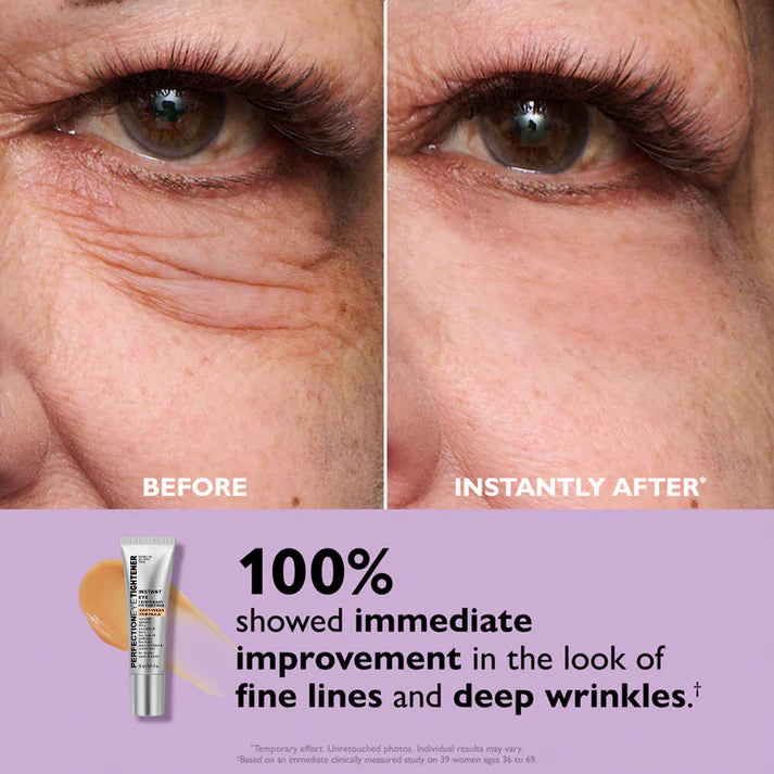 WrinkleAway™ | Erase Bags and Wrinkles in Seconds!