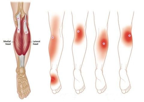 KneeRelief™ | Fast Relief Your Knees Deserve!