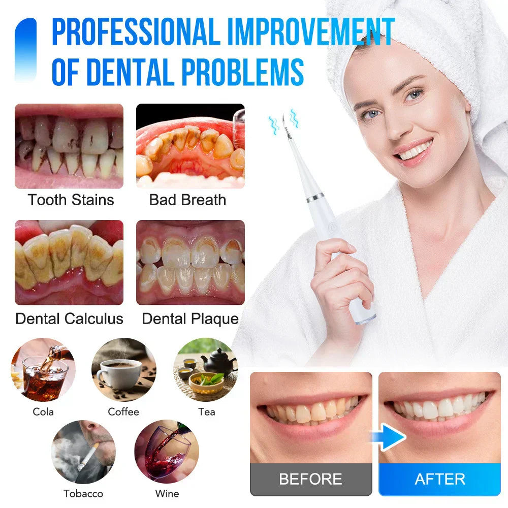 SmilePro™ | Professional Teeth Cleaning, Right At Home!