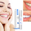 PearlGlow™ | Powerful Teeth Whitener (BEST SELLER)