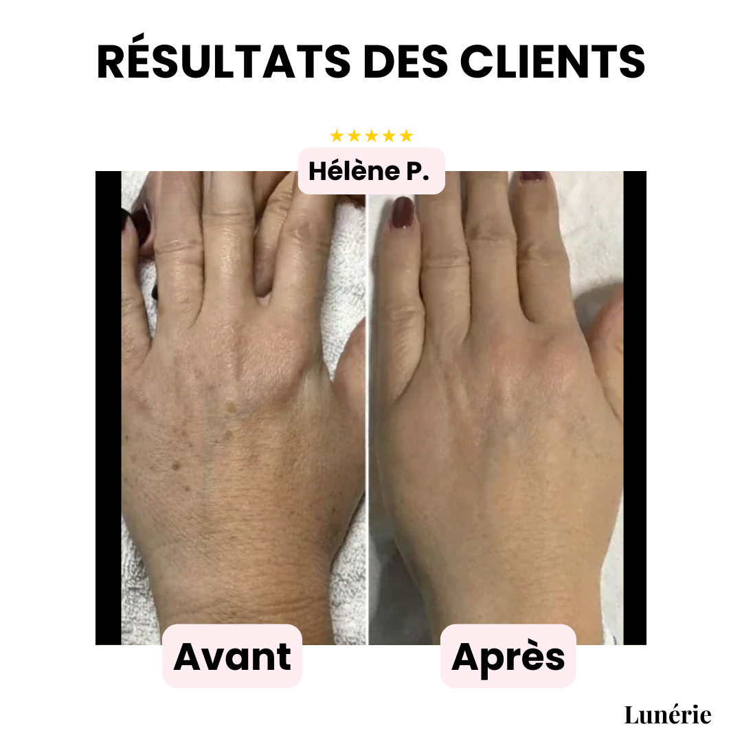 InvisiCover™ | Hide Imperfections, Shine Naturally!