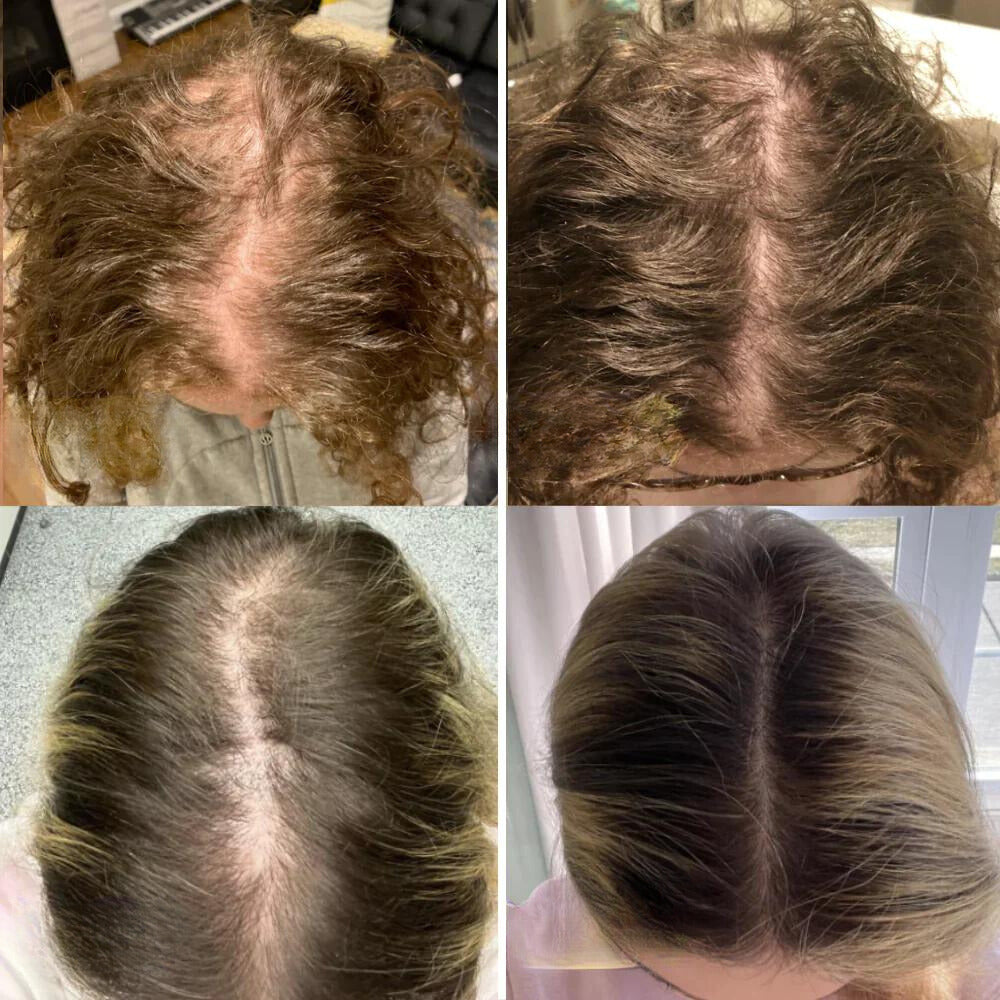GrowEssence™ | The Most Effective Remedy For Fast Hair Growth