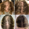 GrowEssence™ | The Most Effective Remedy For Fast Hair Growth