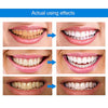 Radiance Elixir™ | Make your smile shine effortlessly