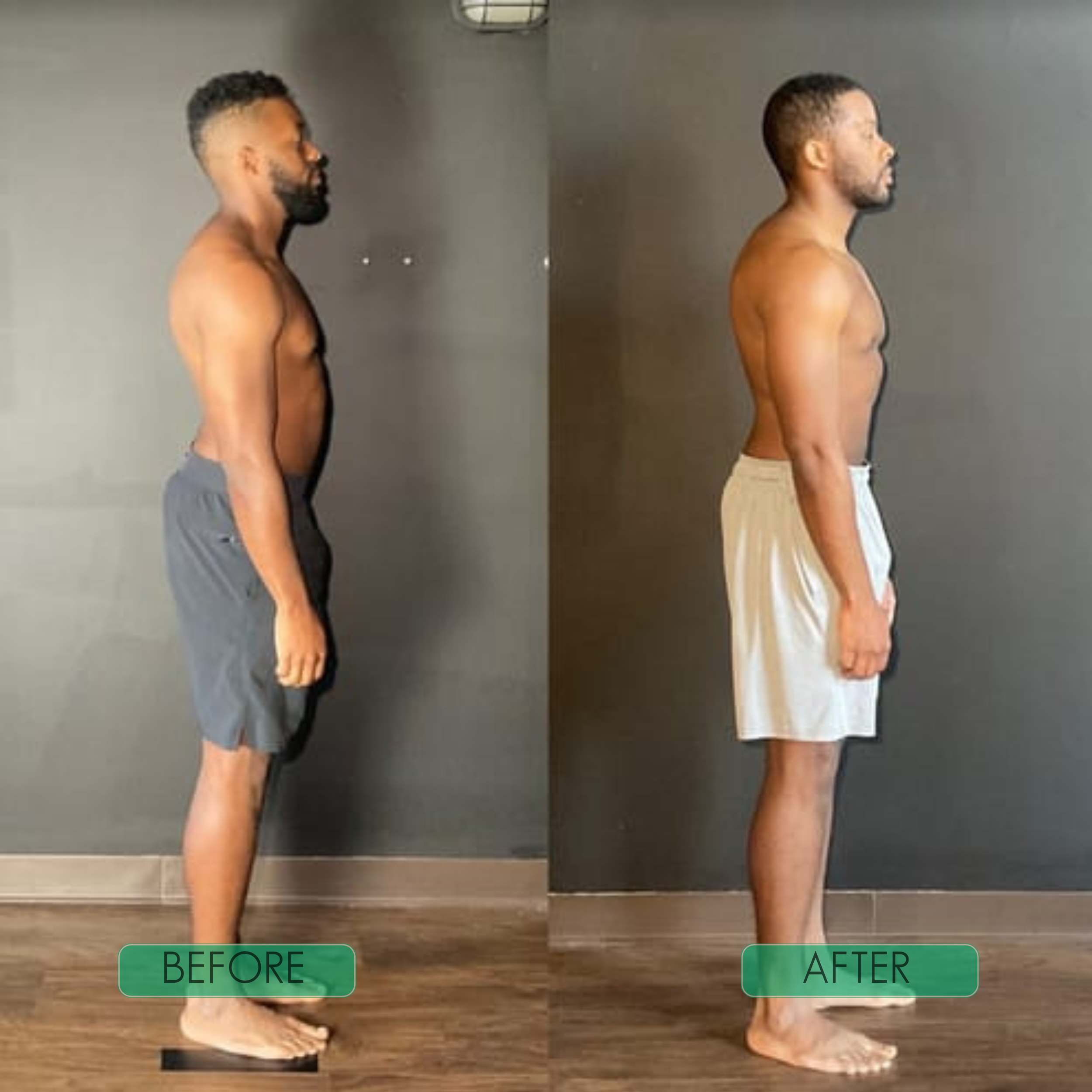 PostureMate™ | Your Everyday Spine Companion!