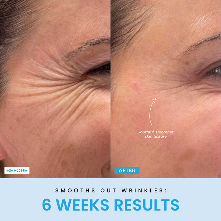 V-Sculpt™ | Redefine Your Jawline in Just 5 Minutes a Day!