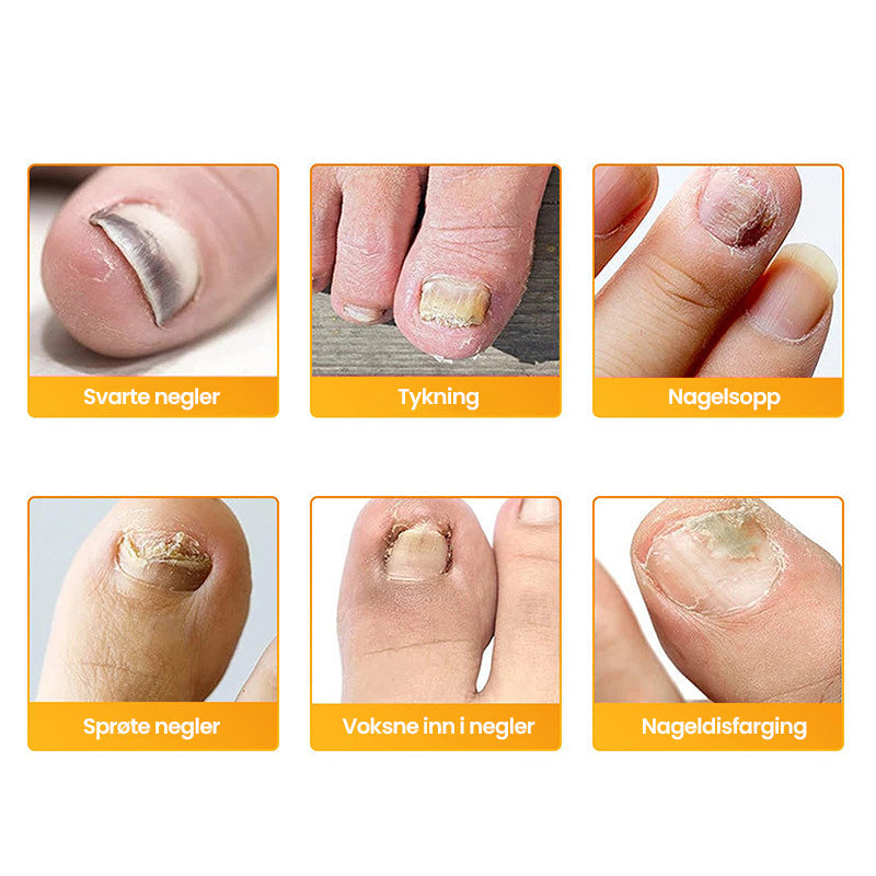 NailRestore™ | Revives Damaged Nails From the Inside Out!