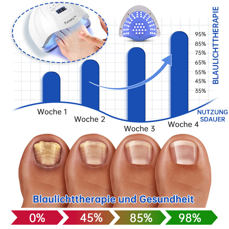 NailEssence™ | Fungus Laser Therapy Device