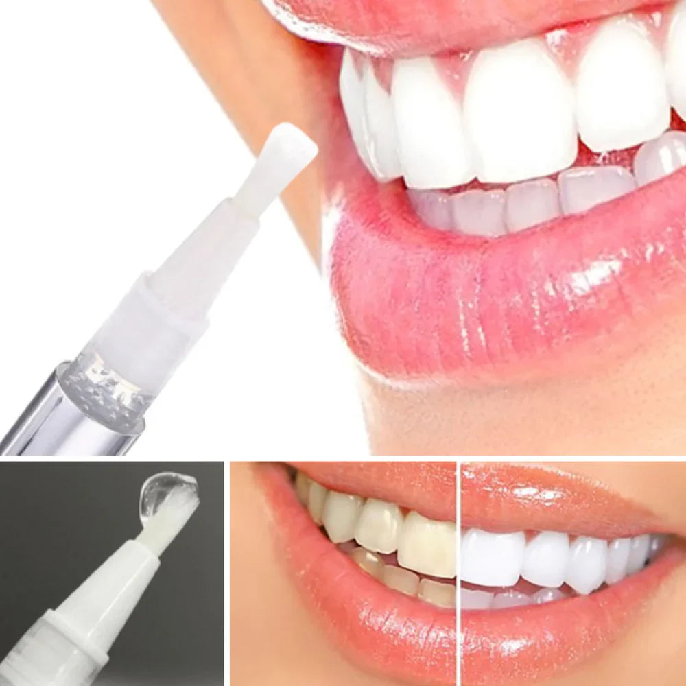 DiamondSmile™ | Radiant Smile in Just 10 Minutes!