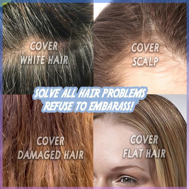 HairLift™ | Hide Thinning Hair Effortlessly!