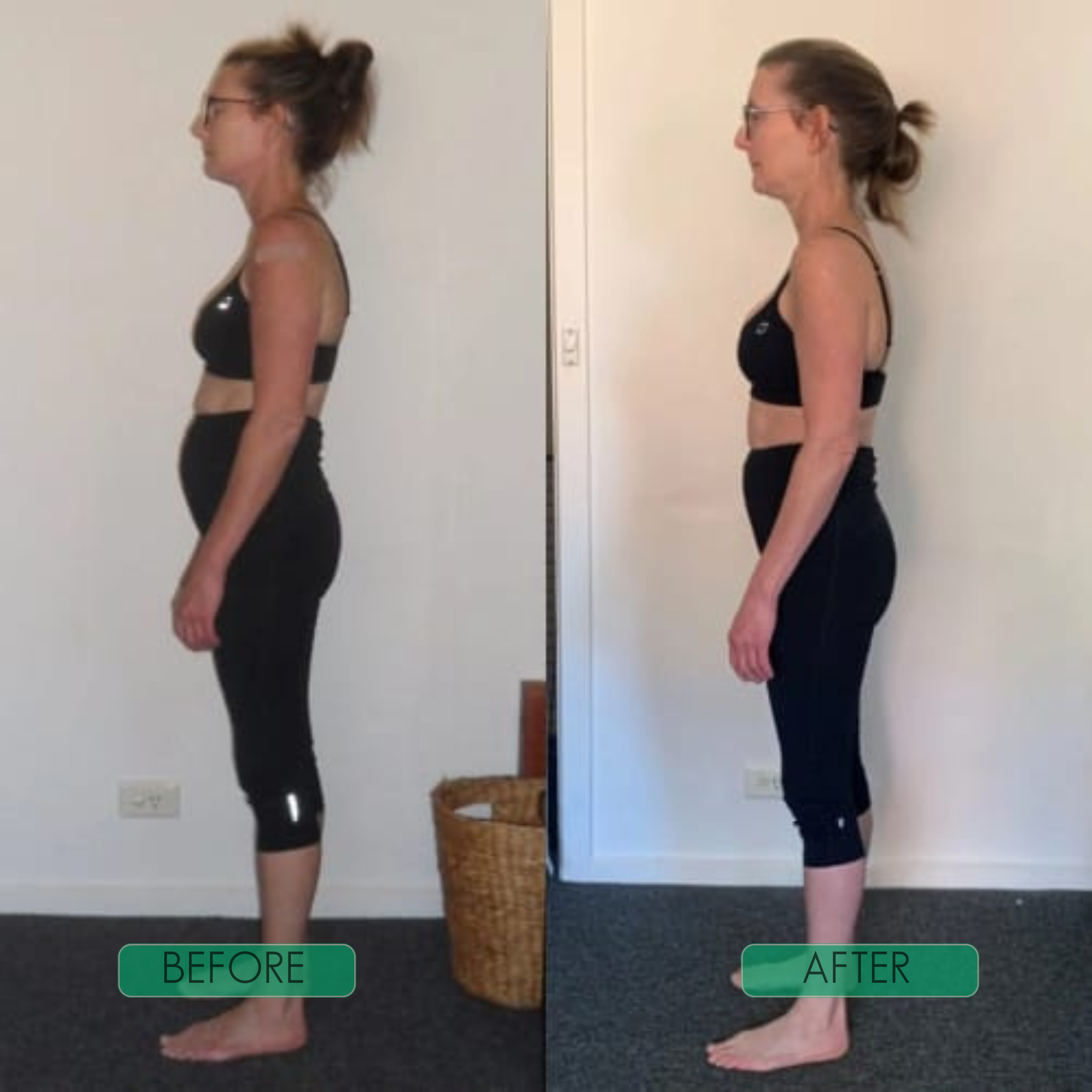 PostureMate™ | Your Everyday Spine Companion!