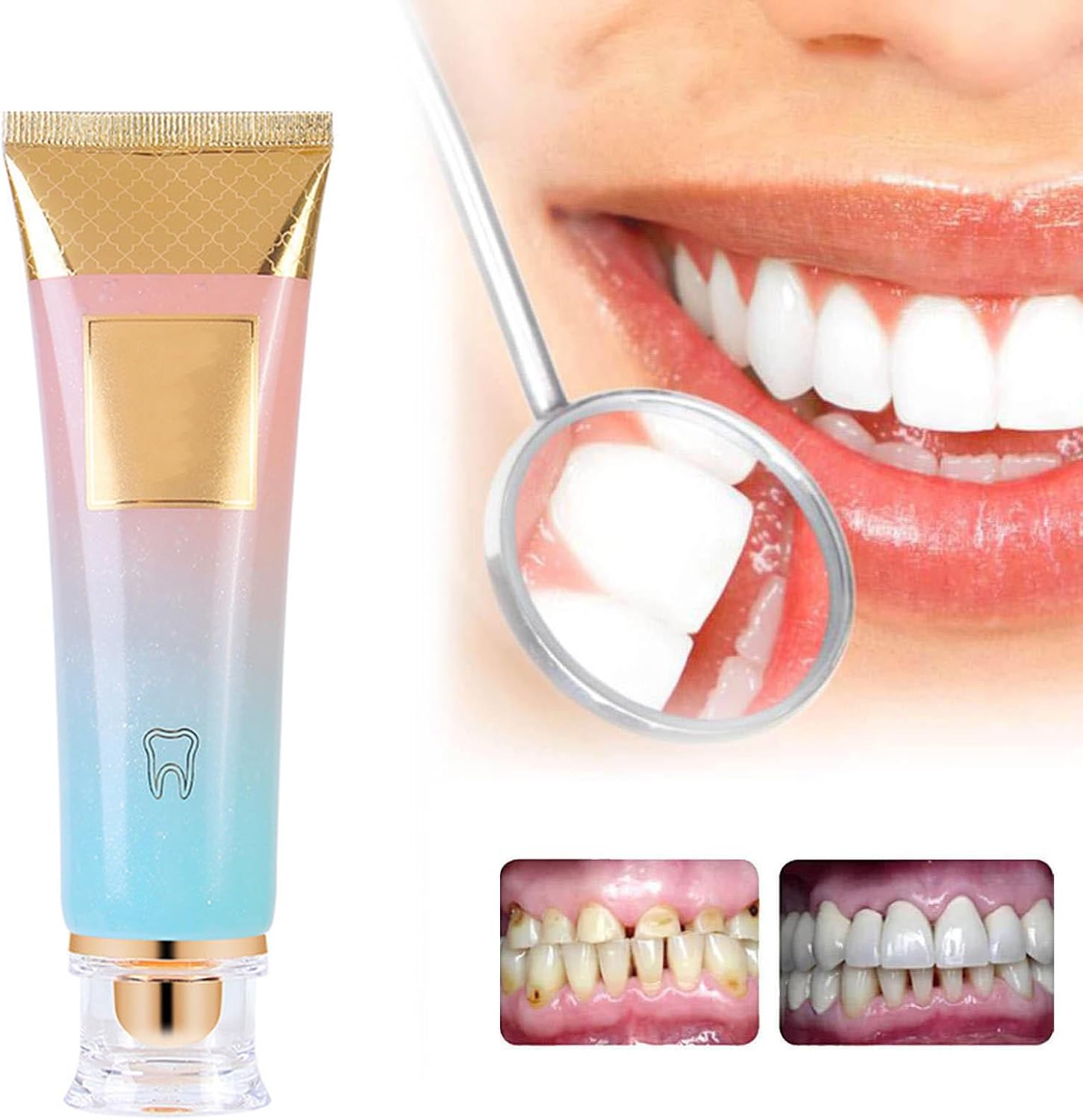 GentleWhite™ | Gentle Whitening for Sensitive Smiles