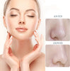 FreshGlow™ | Blackhead Remover Pore Cleansing Serum