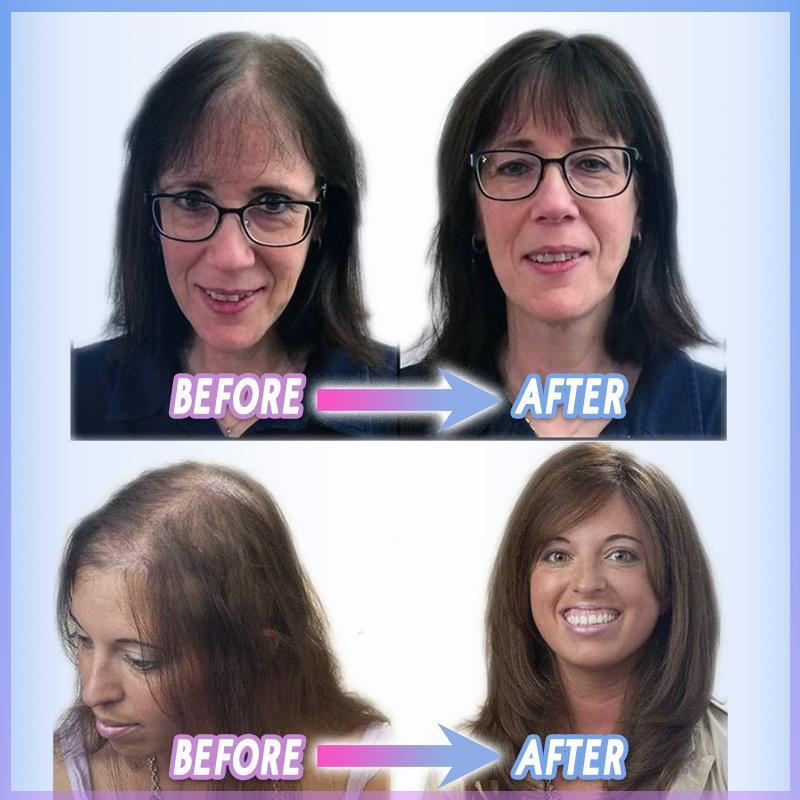 HairLift™ | Hide Thinning Hair Effortlessly!