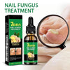 FungaRelief™ | Natural Fungus Removal in 7 Days!