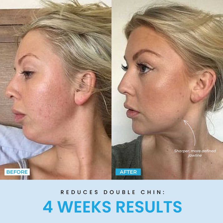 V-Sculpt™ | Redefine Your Jawline in Just 5 Minutes a Day!