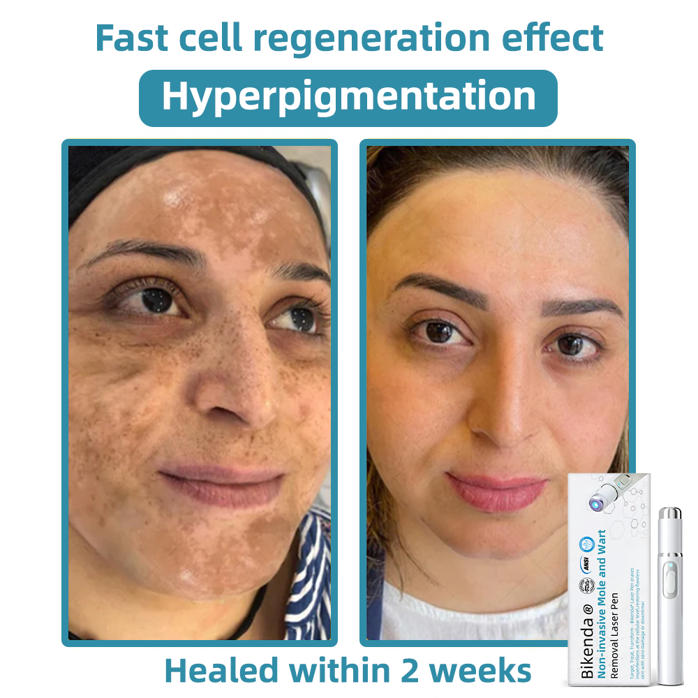 DermaLite™ | Touch Up Your Skin, Painlessly!