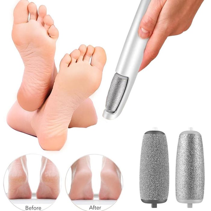 SoleSmooth™ | From Rough Feet to Radiant Feet — In Seconds!