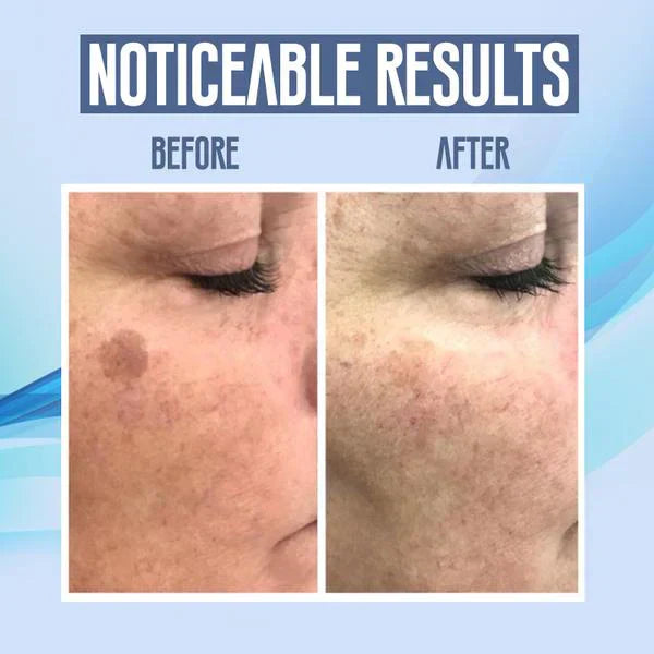 RadiantGlow™ | Dark Spot Vanisher in just Few Weeks