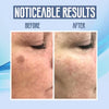 RadiantGlow™ | Dark Spot Vanisher in just Few Weeks