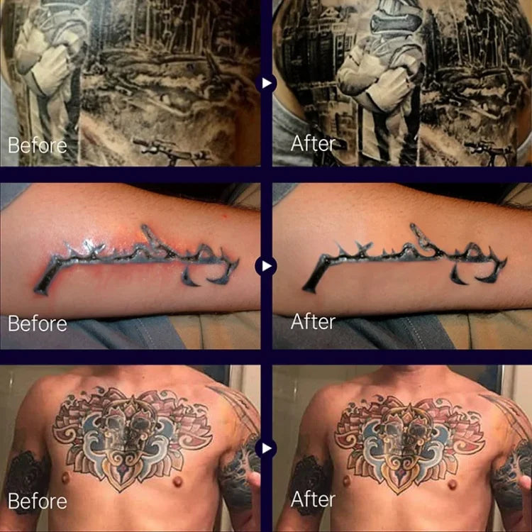 InkRenew™ | Keep Your Tattoo Fresh And Flawless