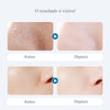 FreshGlow™ | Blackhead Remover Pore Cleansing Serum