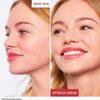 GlowFlawless™ | Say Goodbye To All Imperfections and Discoloration