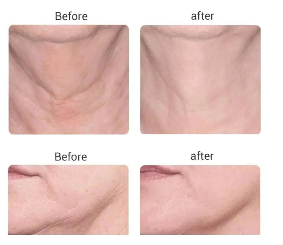 Azure Microcurrent Facial Toner (Last Day Sale!)
