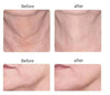 Azure Microcurrent Facial Toner (Last Day Sale!)