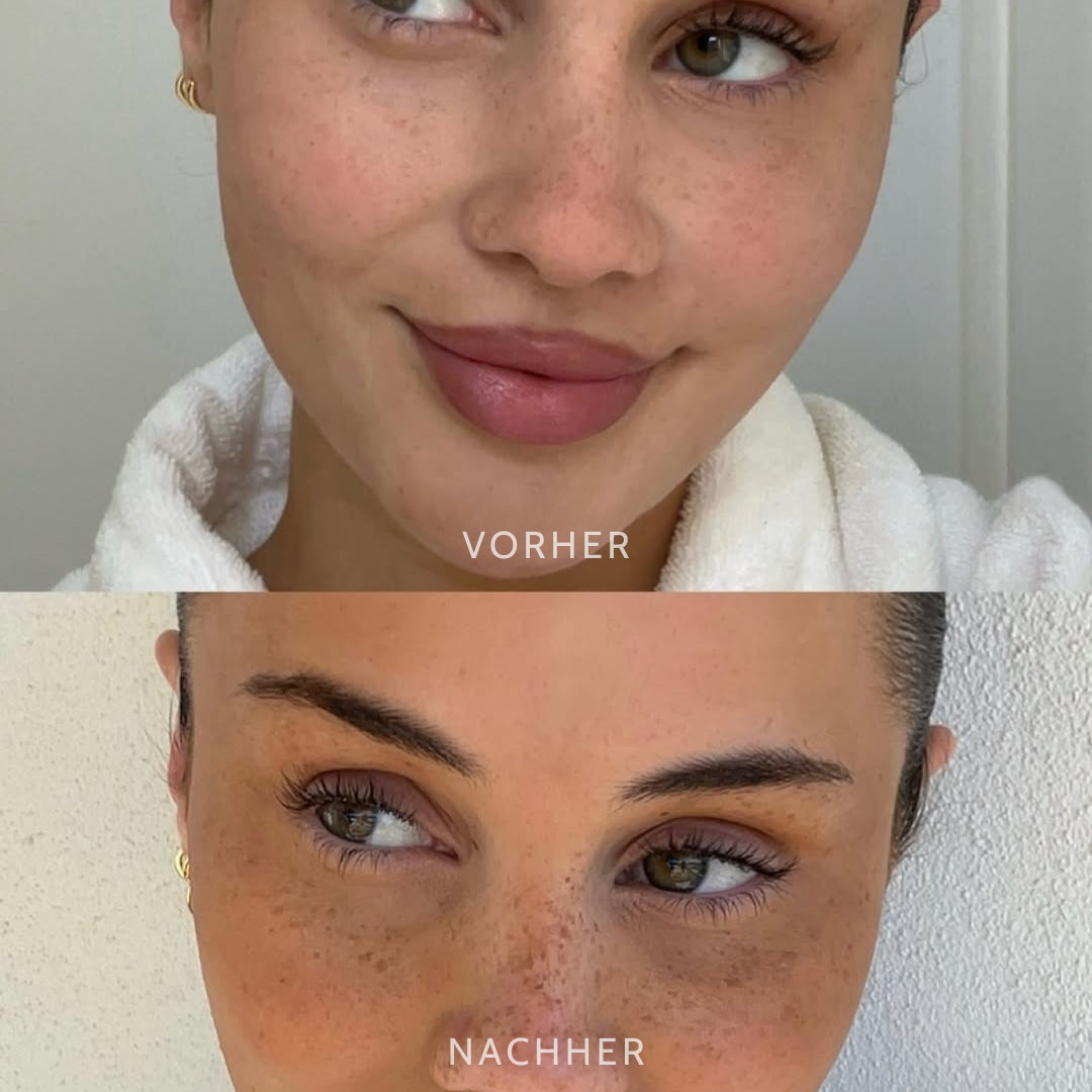 FreckleFlick™ | Stamp On Perfectly Natural-Looking Freckles In Seconds