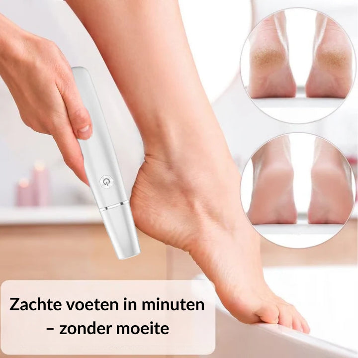 SoleSmooth™ | From Rough Feet to Radiant Feet — In Seconds!