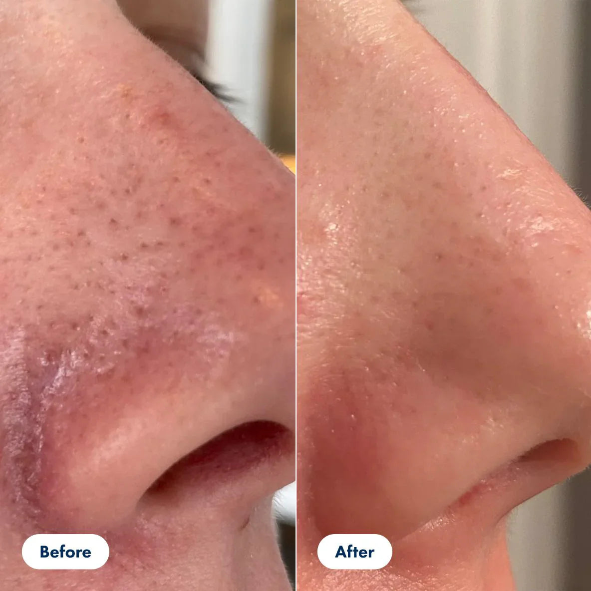 GlowGrain™ | Unclog Pores & Lift Dull Skin – Gently, Naturally!