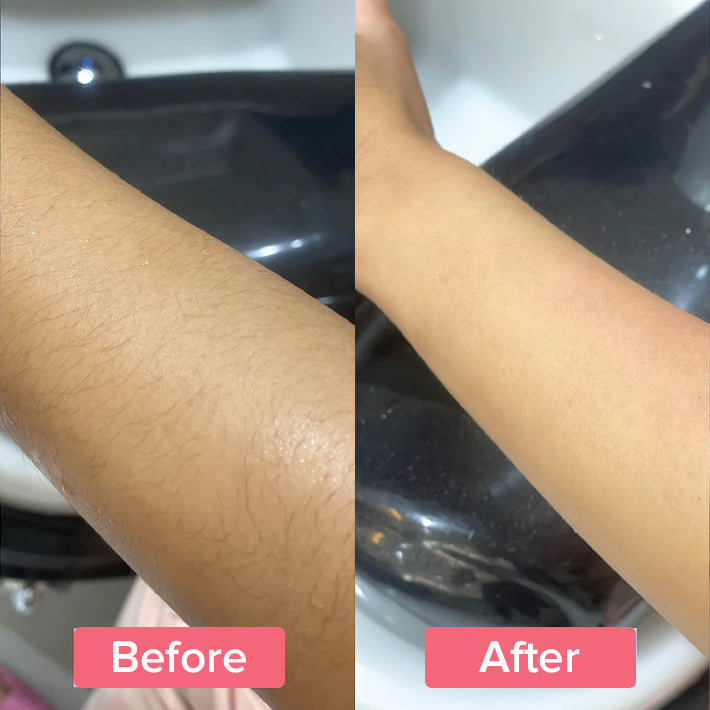 SilkySmooth™ | Hair Remover